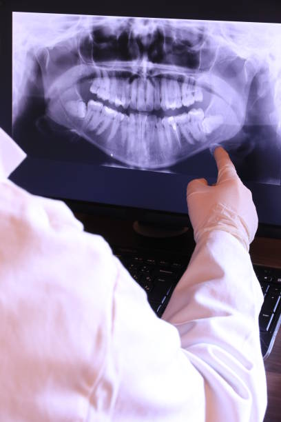 Best Emergency Treatment for Oral Infections in Elkridge, MD